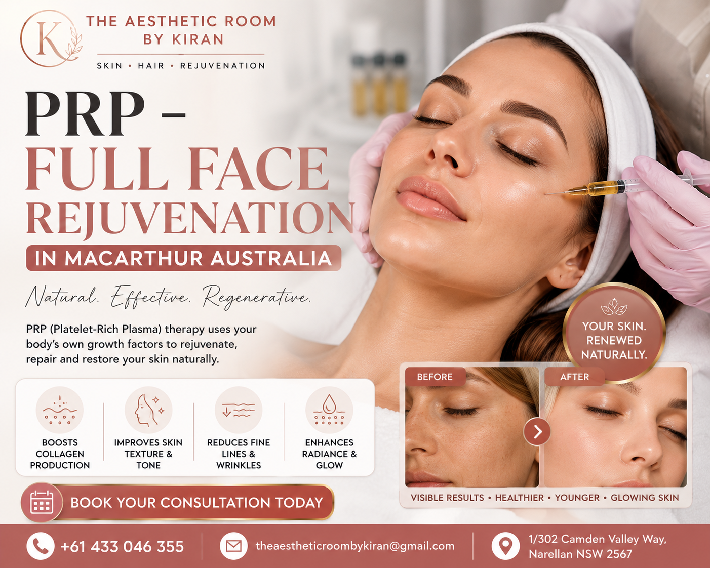 PRP – Full Face Rejuvenation in MacArthur Australia
