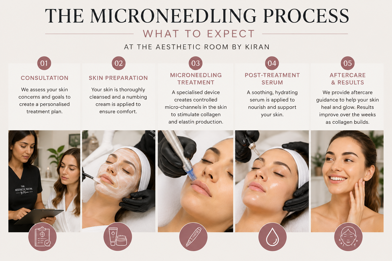 Microneedling Treatment Process Camden NSW