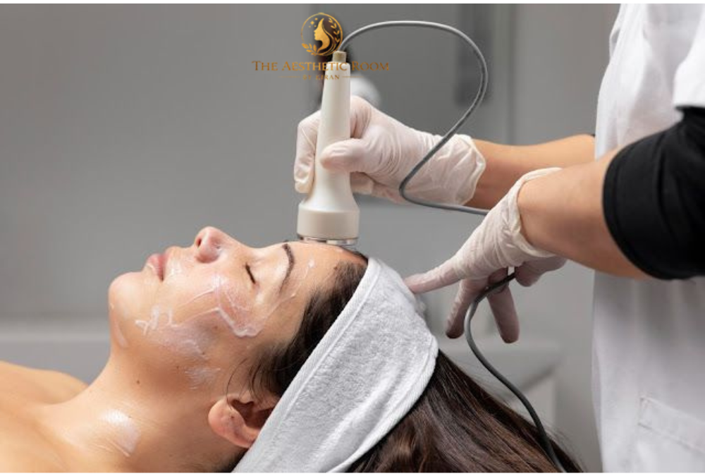 Microneedling for Acne Scars: Benefits, Recovery, and Results with professional skin needling treatment in Narellan NSW