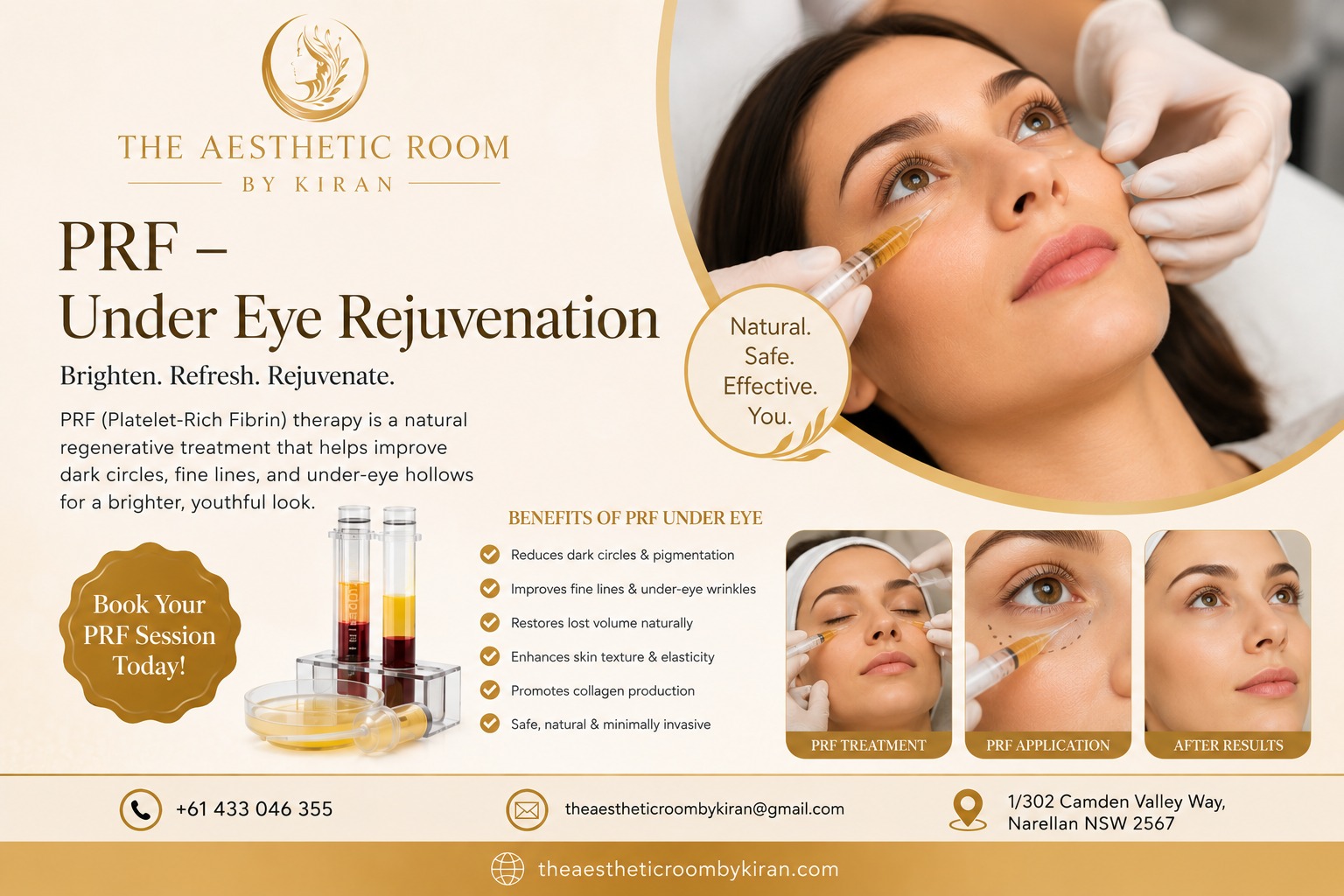 PRF Under Eye Rejuvenation in Leppington NSW Australia