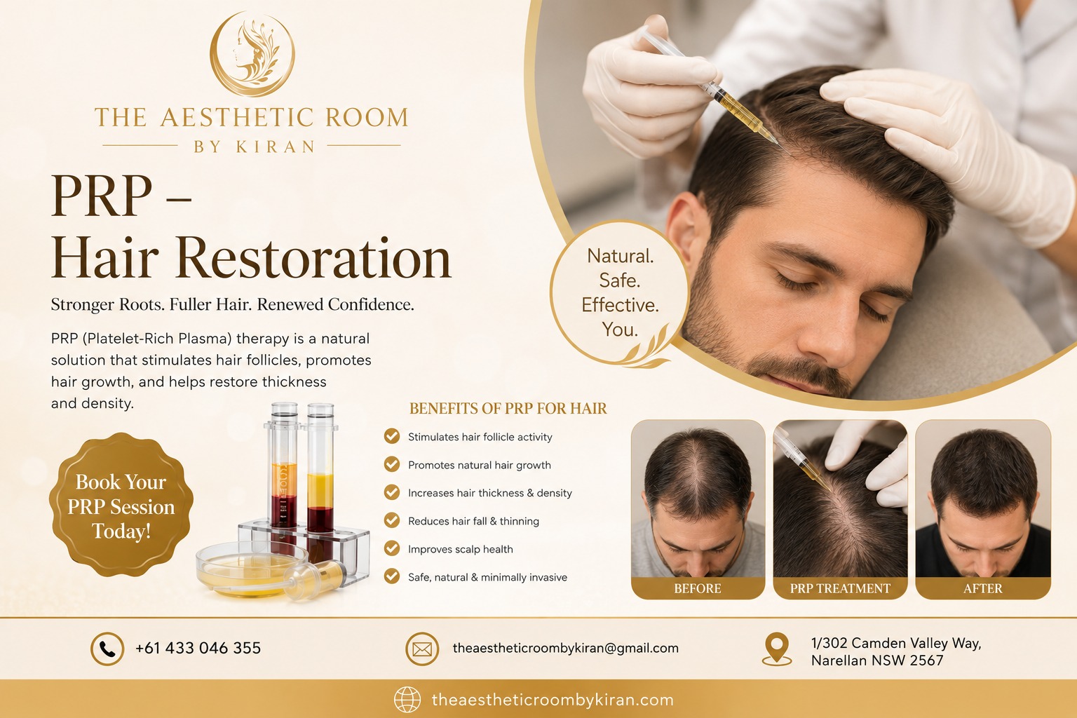 PRP Hair Restoration Leppington NSW Australia treatment for natural hair regrowth and scalp rejuvenation