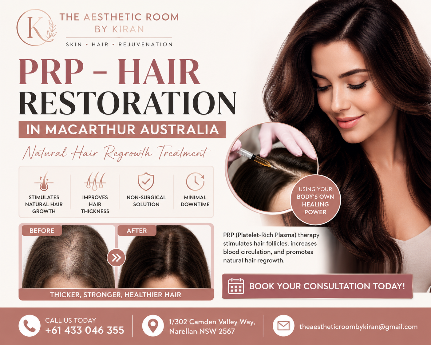 PRP – Hair Restoration in MacArthur Australia