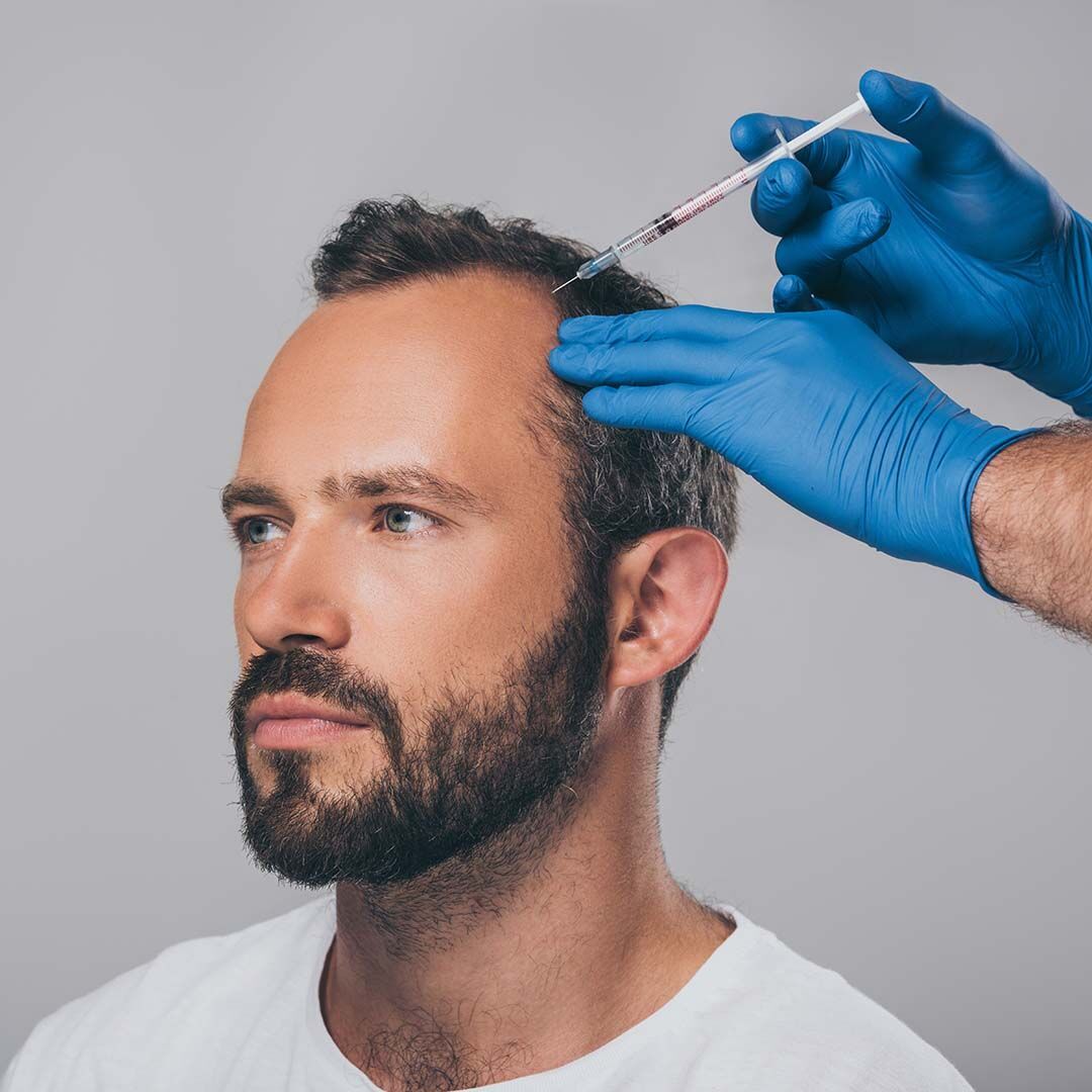 PRP – Hair Restoration in Harrington Grove Australia
