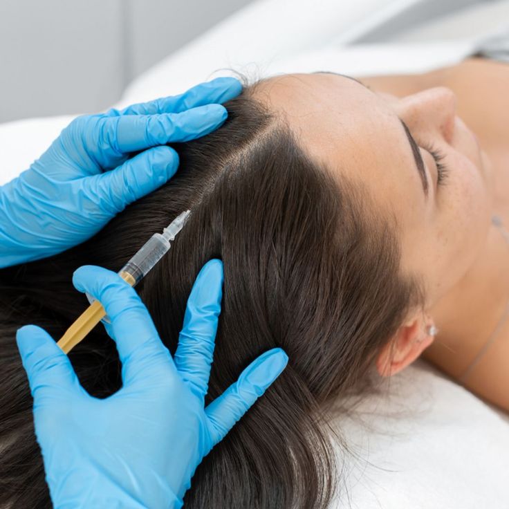 PRP – Hair Restoration in MacArthur Australia