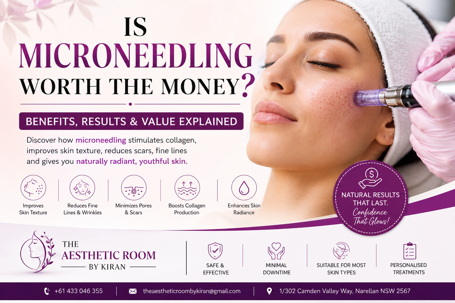 Professional microneedling treatment for skin rejuvenation, acne scars, collagen stimulation, and anti-aging at The Aesthetic Room by Kiran in Narellan NSW