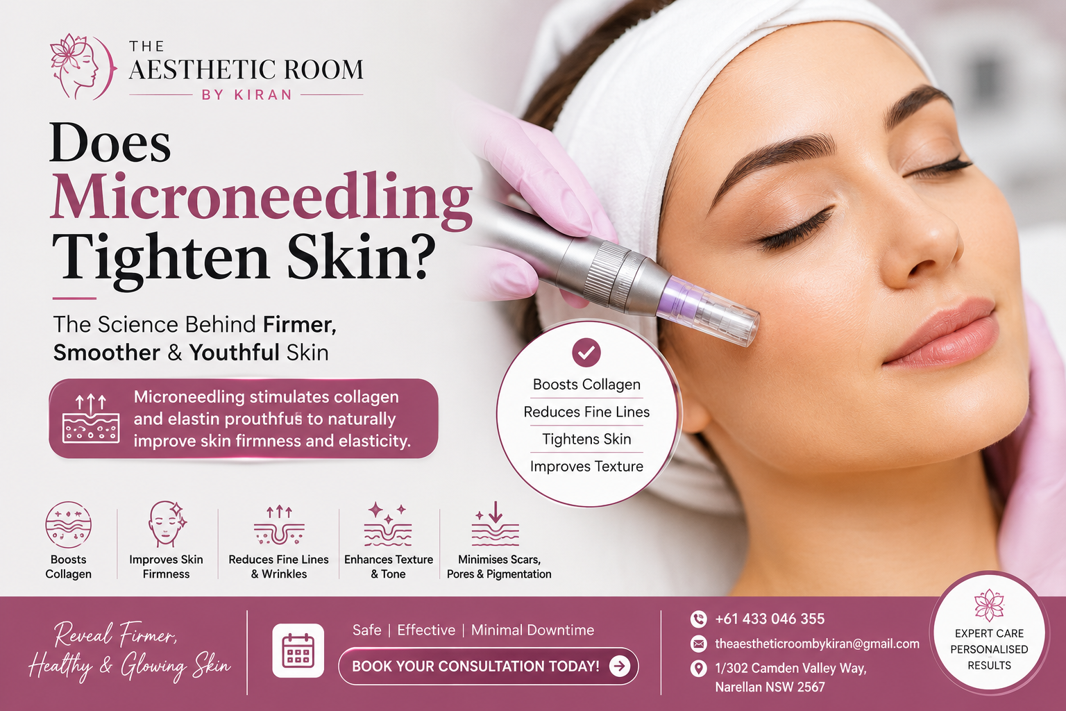 Professional microneedling treatment that tightens skin naturally by stimulating collagen production, reducing fine lines, improving skin texture, and enhancing skin elasticity at The Aesthetic Room by Kiran, Narellan NSW.