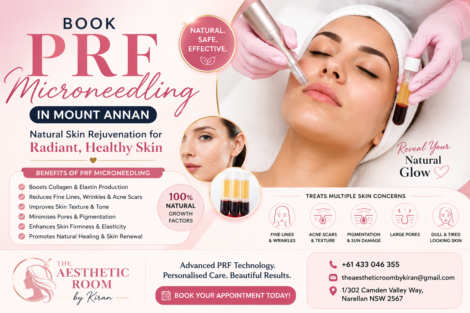 Book PRF microneedling in Mount Annan at The Aesthetic Room by Kiran for natural collagen stimulation, skin rejuvenation, acne scar improvement, and healthier glowing skin.
