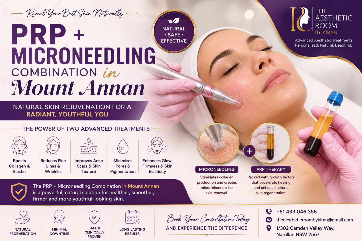 PRP + Microneedling Combination in Mount Annan performed by The Aesthetic Room by Kiran, showing advanced skin rejuvenation, collagen induction therapy, platelet-rich plasma treatment, microneedling procedure, glowing skin, acne scar reduction, and anti-ageing facial treatment in NSW.