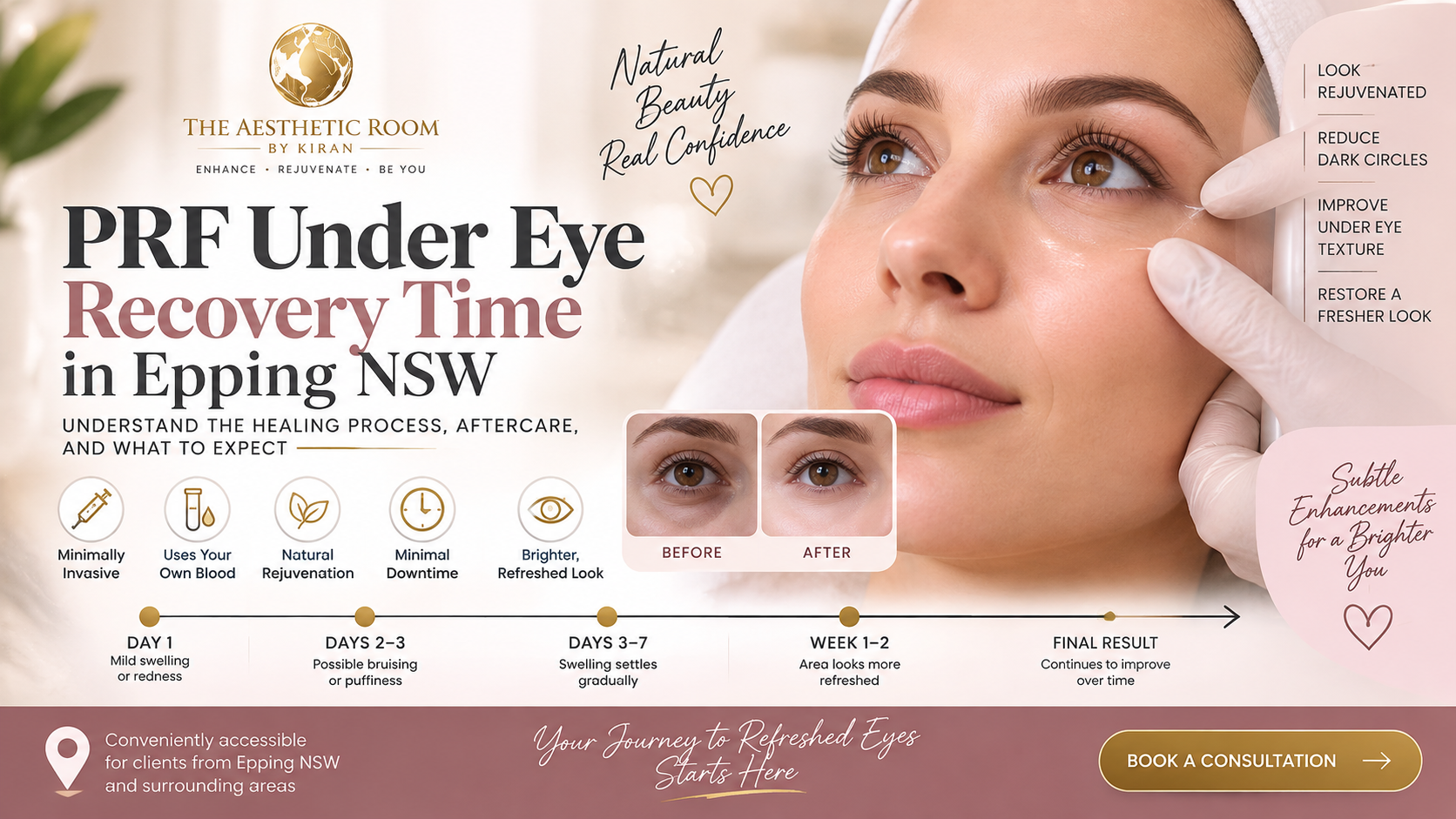 PRF Under Eye Recovery Time in Epping NSW at The Aesthetic Room by Kiran