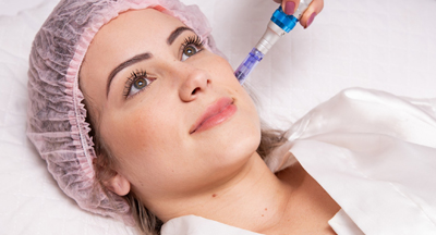 PRP Mesotherapy + Microneedling Treatment